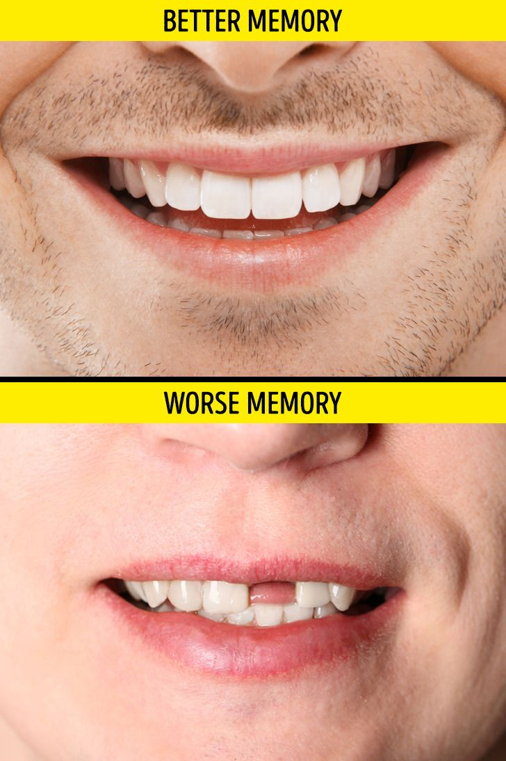 Sức khỏe răng miệng được kết nối với trí nhớ của chúng ta